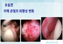성인간호학(근골격계질환,은하출판사) 29페이지