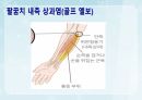 성인간호학(근골격계질환,은하출판사) 36페이지