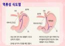 성인간호학(소화기계질환,은하출판사) 22페이지