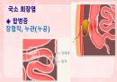 성인간호학(소화기계질환,은하출판사) 57페이지