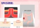 성인간호학(소화기계질환,은하출판사) 74페이지
