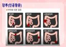 성인간호학(소화기계질환,은하출판사) 76페이지