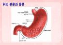 성인간호학(소화기계질환,은하출판사) 84페이지