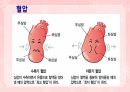 성인간호학(순환기계질환,은하출판사) 9페이지