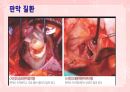 성인간호학(순환기계질환,은하출판사) 39페이지