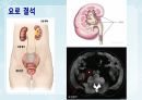 성인간호학(비뇨생식기계질환,은하출판사) 50페이지
