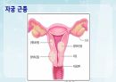 성인간호학(비뇨생식기계질환,은하출판사) 86페이지