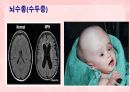 성인간호학(신경계질환,은하출판사) 17페이지