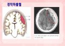 성인간호학(신경계질환,은하출판사) 19페이지