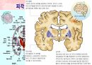 성인간호학(신경계질환,은하출판사) 25페이지