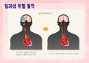 성인간호학(신경계질환,은하출판사) 26페이지
