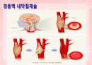 성인간호학(신경계질환,은하출판사) 28페이지