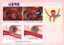 성인간호학(신경계질환,은하출판사) 30페이지