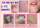 성인간호학(피부계질환,은하출판사) 12페이지