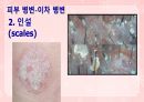 성인간호학(피부계질환,은하출판사) 18페이지