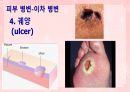 성인간호학(피부계질환,은하출판사) 20페이지