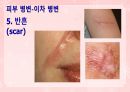 성인간호학(피부계질환,은하출판사) 21페이지