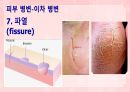 성인간호학(피부계질환,은하출판사) 23페이지