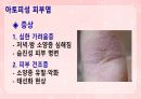 성인간호학(피부계질환,은하출판사) 37페이지