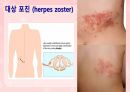성인간호학(피부계질환,은하출판사) 49페이지