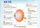 성인간호학(안과질환,은하출판사) 5페이지