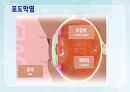 성인간호학(안과질환,은하출판사) 24페이지