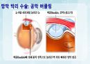 성인간호학(안과질환,은하출판사) 28페이지