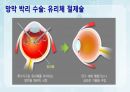 성인간호학(안과질환,은하출판사) 30페이지