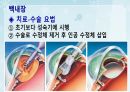 성인간호학(안과질환,은하출판사) 34페이지