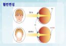 성인간호학(안과질환,은하출판사) 43페이지