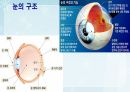 성인간호학(안과질환,은하출판사) 48페이지