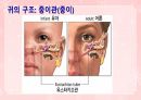 성인간호학(이비인후과질환,은하출판사) 8페이지