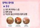 성인간호학(이비인후과질환,은하출판사) 22페이지