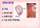 성인간호학(이비인후과질환,은하출판사) 23페이지