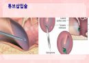 성인간호학(이비인후과질환,은하출판사) 24페이지