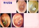 성인간호학(이비인후과질환,은하출판사) 25페이지