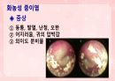 성인간호학(이비인후과질환,은하출판사) 28페이지
