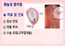 성인간호학(이비인후과질환,은하출판사) 29페이지