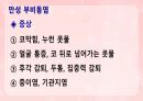 성인간호학(이비인후과질환,은하출판사) 48페이지