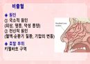 성인간호학(이비인후과질환,은하출판사) 50페이지