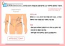 [성인간호학실습]appendectomy충수절제술 수술과정ppt발표 충수염부터 수술기구.과정.후간호까지 사진 많고 꼼꼼함 6페이지