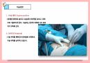 [성인간호학실습]appendectomy충수절제술 수술과정ppt발표 충수염부터 수술기구.과정.후간호까지 사진 많고 꼼꼼함 13페이지