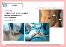[성인간호학실습]appendectomy충수절제술 수술과정ppt발표 충수염부터 수술기구.과정.후간호까지 사진 많고 꼼꼼함 15페이지