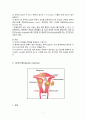 Uterine myoma 사례연구, 간호사례, case study 7페이지