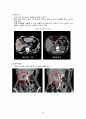 간담도계 질환 및 관리 35페이지