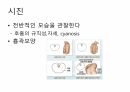 호흡기계간호(중환자실) 16페이지