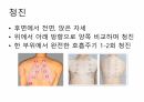 호흡기계간호(중환자실) 20페이지