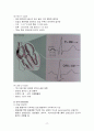 심전도와 심장질환 19페이지