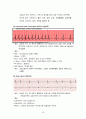심전도와 심장질환 26페이지
