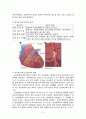 허혈성 심질환(협심증, 심근경색) 9페이지